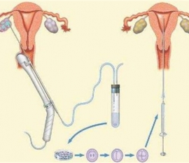 上海捐卵宝宝取名字要避免某些字