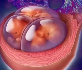 孕妇和上海捐卵宝宝要当心“温暖”的伤害